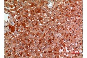 Immunohistochemistry (IHC) analysis of paraffin-embedded Human Liver, antibody was diluted at 1:100. (alpha 2 Macroglobulin 抗体  (Internal Region))
