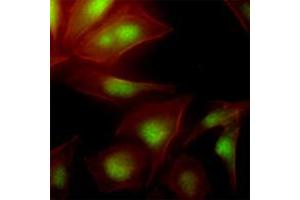 Immunofluorescence (IF) image for anti-Ubiquitin-Conjugating Enzyme E2S (UBE2S) (AA 1-222), (N-Term) antibody (ABIN452460) (UBE2S 抗体  (N-Term))