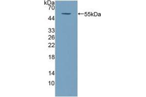 Western blot analysis of recombinant Human COQ6. (COQ6 抗体  (AA 1-468))