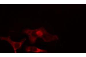ABIN6266897 staining HeLa cells by IF/ICC. (ELOVL4 抗体  (Internal Region))