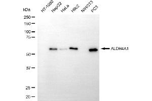 anti-Aldehyde Dehydrogenase 4 Family, Member A1 (ALDH4A1) antibody