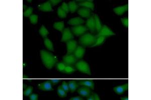 Immunofluorescence analysis of U2OS cells using CAMK1 Polyclonal Antibody (CAMK1 抗体)