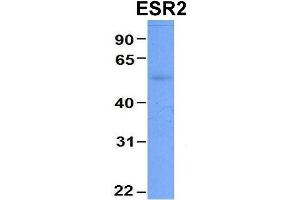 Host:  Rabbit  Target Name:  CHAD  Sample Type:  Human Adult Placenta  Antibody Dilution:  1. (ESR2 抗体  (Middle Region))