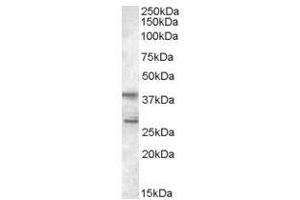 Image no. 1 for anti-Src Kinase Associated Phosphoprotein 2 (SKAP2) (C-Term) antibody (ABIN374180) (SKAP2 抗体  (C-Term))