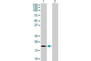 Lane 1: MAP1LC3A transfected lysate ( 13. (MAP1LC3A 293T Cell Transient Overexpression Lysate(Denatured))