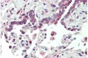 Human, Lung: Formalin-Fixed Paraffin-Embedded (FFPE) (VARS 抗体  (AA 576-625))