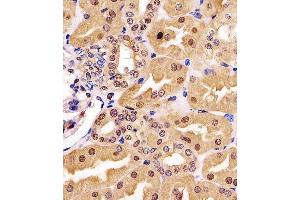 (ABIN6243211 and ABIN6577174) staining GDH in human kidney tissue sections by Immunohistochemistry (IHC-P - paraformaldehyde-fixed, paraffin-embedded sections). (GAPDH 抗体  (AA 43-335))