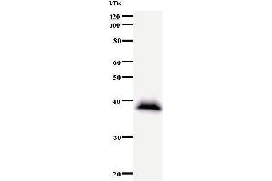 Western Blotting (WB) image for anti-General Transcription Factor IIIC, Polypeptide 2, beta 110kDa (GTF3C2) antibody (ABIN931065) (GTF3C2 抗体)