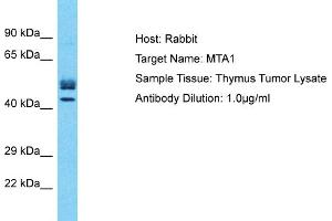 Host: Rabbit Target Name: MTA1 Sample Type: Thymus Tumor lysates Antibody Dilution: 1. (MTA1 抗体  (Middle Region))