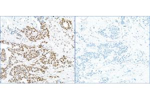 Immunohistochemistry (IHC) image for anti-Replication Protein A2, 32kDa (RPA2) (pSer4), (pSer8) antibody (ABIN7455212) (RPA2 抗体  (pSer4, pSer8))