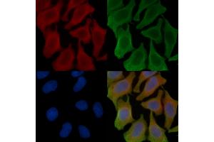 ABIN6257478 and ABIN6273810 staining Hela cells(45 min of heat-shock treatment) by IF/ICC. (TYRO3 抗体  (C-Term))