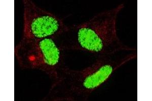 Fluorescent confocal image of SY5Y cells stained with phospho-LIN28 antibody. (LIN28A 抗体  (pSer134))