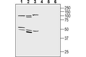 1-3. (Adiponectin Receptor 1 抗体  (Intracellular, N-Term))