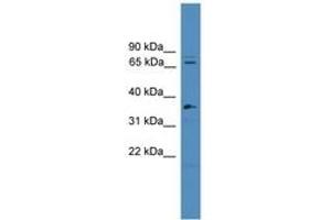 Image no. 1 for anti-Splicing Factor 4 (SF4) (C-Term) antibody (ABIN6745313) (Splicing Factor 4 抗体  (C-Term))