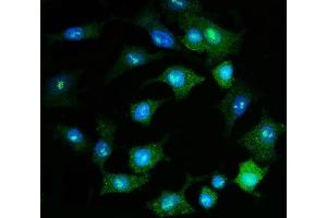 IF analysis of PSMD8 using anti-PSMD8 antibody (ABIN7602571).