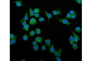 IF analysis of Podoplanin/gp36/Pdpn using anti-Podoplanin/gp36/Pdpn antibody (ABIN7600811). (Podoplanin 抗体  (AA 24-172))