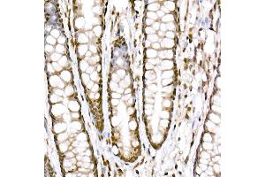 anti-PR Domain Containing 9 (PRDM9) antibody