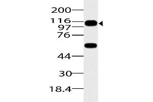 Image no. 1 for anti-ArfGAP with SH3 Domain, Ankyrin Repeat and PH Domain 1 (ASAP1) (AA 912-1115) antibody (ABIN5027041) (ASAP1 抗体  (AA 912-1115))