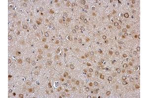 IHC-P Image Galanin Receptor 2 antibody detects Galanin Receptor 2 protein at membrane and cytosol on rat fore brain by immunohistochemical analysis. (GALR2 抗体  (C-Term))