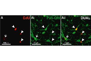 Representative confocal images of colocalisation of EdU+ and Pan-QKI in the dorsal WM of mouse spinal cord. (QKI 抗体  (pan))