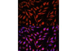Immunofluorescence (IF) image for anti-F-Box Protein 21 (FBXO21) (AA 440-621) antibody (ABIN7267085)