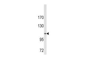 Western Blotting (WB) image for anti-Collagen, Type VI, alpha 1 (COL6A1) (AA 48-77), (N-Term) antibody (ABIN390512)