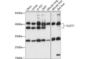 Western Blotting (WB) image for anti-SGT1, Suppressor of G2 Allele of SKP1 (SUGT1) (AA 159-333) antibody (ABIN7270270)