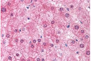 Human Liver (formalin-fixed, paraffin-embedded) stained with EIF2AK2 antibody ABIN213926 at 5 ug/ml followed by biotinylated goat anti-rabbit IgG secondary antibody ABIN481713, alkaline phosphatase-streptavidin and chromogen. (EIF2AK2 抗体  (N-Term))