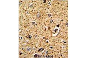 Immunohistochemistry (IHC) image for anti-Tryptophan Hydroxylase 1 (TPH1) antibody (ABIN3002887) (Tryptophan Hydroxylase 1 抗体)