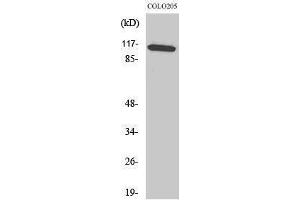 Western Blotting (WB) image for anti-Mitogen-Activated Protein Kinase 8 Interacting Protein 1 (MAPK8IP1) (Tyr466) antibody (ABIN3185263) (MAPK8IP1 抗体  (Tyr466))