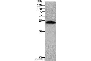 Western blot analysis of Human lung tissue, using BPIFB2 Polyclonal Antibody at dilution of 1:530 (BPIL1 抗体)