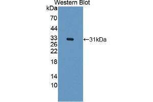 Western blot analysis of the recombinant protein. (CARD9 抗体  (AA 26-283))