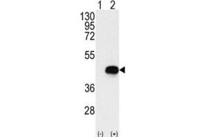 Western Blotting (WB) image for anti-Branched Chain Ketoacid Dehydrogenase Kinase (BCKDK) antibody (ABIN3003001) (BCKDK 抗体)