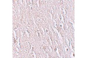 Immunohistochemical staining of human brain cells with ZBTB5 polyclonal antibody  at 2.