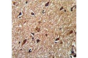 Immunohistochemistry (IHC) image for anti-Isocitrate Dehydrogenase 1 (NADP+), Soluble (IDH1) (AA 63-90) antibody (ABIN3031507)