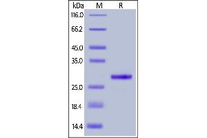 Recombinant Protein G, His Tag on  under reducing (R) condition. (Protein G Protein (His tag))