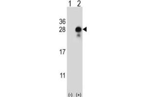 Western Blotting (WB) image for anti-delta-Like 2 Homolog (DLK2) antibody (ABIN3004005) (DLK2 抗体)