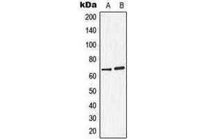 Western blot analysis of Arylsulfatase D expression in A549 (A), ZR751 (B) whole cell lysates. (Arylsulfatase D 抗体  (Center))