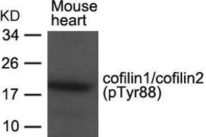 Western blot analysis of extracts from Mouse heart tissue using cofilin1/cofilin2(phospho-Tyr88) Antibody. (Cofilin1/2 (CFL1/2) (pTyr88) 抗体)