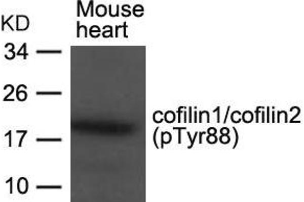 Cofilin1/2 (CFL1/2) (pTyr88) 抗体