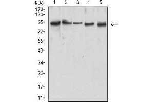 Western blot analysis using MLH1 mouse mAb against Hela (1), Jurkat (2), A431 (3), HepG2 (4), and MCF-7 (5) cell lysate.