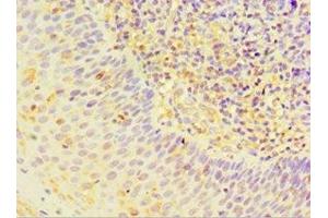 Immunohistochemistry of paraffin-embedded human tonsil tissue using ABIN7170823 at dilution of 1:100 (Striatin 抗体  (AA 581-780))