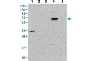 Western blot analysis of Lane 1: RT-4, Lane 2: U-251 MG, Lane 3: Human Plasma, Lane 4: Liver, Lane 5: Tonsil with ARHGAP19 polyclonal antibody . (ARHGAP19 抗体)