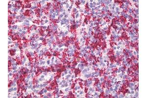 Anti-HMOX1 / HO-1 antibody IHC staining of human spleen, macrophages.