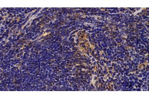 Immunohistochemistry (IHC) image for anti-Charcot-Leyden Crystal Protein (CLC) (AA 2-142) antibody (ABIN7434860)