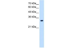 Western Blotting (WB) image for anti-Solute Carrier Family 7 (Amino Acid Transporter, L-Type), Member 8 (SLC7A8) (Middle Region) antibody (ABIN2781629)