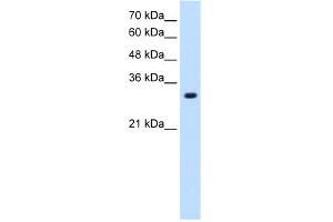 WB Suggested Anti-SLC7A8 Antibody Titration:  1. (SLC7A8 抗体  (Middle Region))