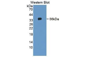 Western blot analysis of the recombinant protein. (AGRN 抗体  (AA 1130-1401))