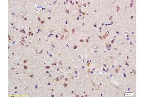 Formalin-fixed and paraffin embedded rat brain labeled with Anti-RGC32 Polyclonal Antibody, Unconjugated  at 1:200 followed by conjugation to the secondary antibody and DAB staining (RGC32 抗体  (AA 98-137))