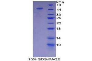 SDS-PAGE analysis of Pig Complement Component 7 Protein. (C7 蛋白)